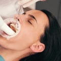 The Truth About Teeth Cleaning: How Often Do You Really Need It?