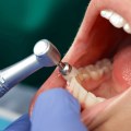 The Importance of Regular Dental Cleanings