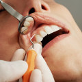 The Importance of Regular Dental Cleanings for Preventing Tooth Decay