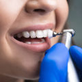 The Importance of Professional Teeth Cleaning for Oral and General Health