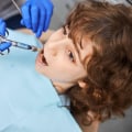 The Importance of Numbing for Teeth Cleaning