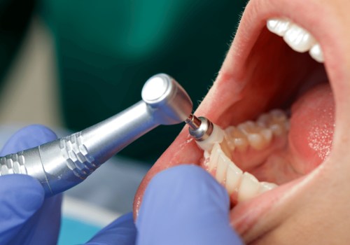 The Importance of Regular Dental Cleanings