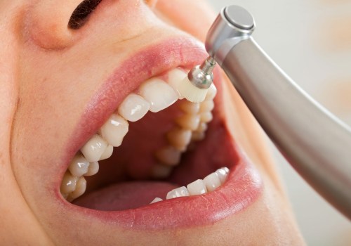 The Importance of Regular Dental Cleanings for Optimal Oral and Overall Health