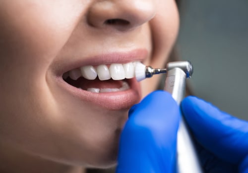 The Importance of Regular Dental Cleanings