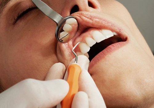 The Importance of Regular Dental Cleanings for Preventing Tooth Decay